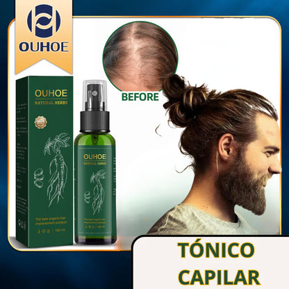 OUHOE ® ELIXIR CRECIMIENTO Y CONTROL DE CAIDA CAPILAR !