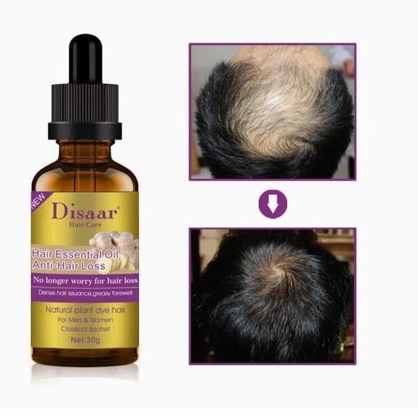 Disaar® Serum Para Crecimiento Acelerado del Cabello