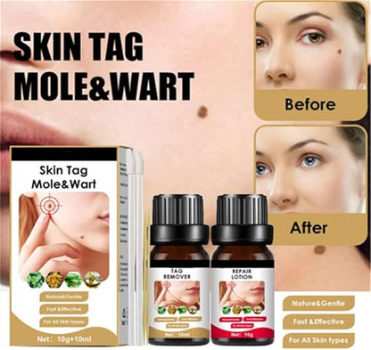 2X1 SKIN TAG MOLE & WART™  - TONICO Y CREMA ELIMINADOR DE VERRUGAS, LUNARES Y MARCAS EN LA PIEL