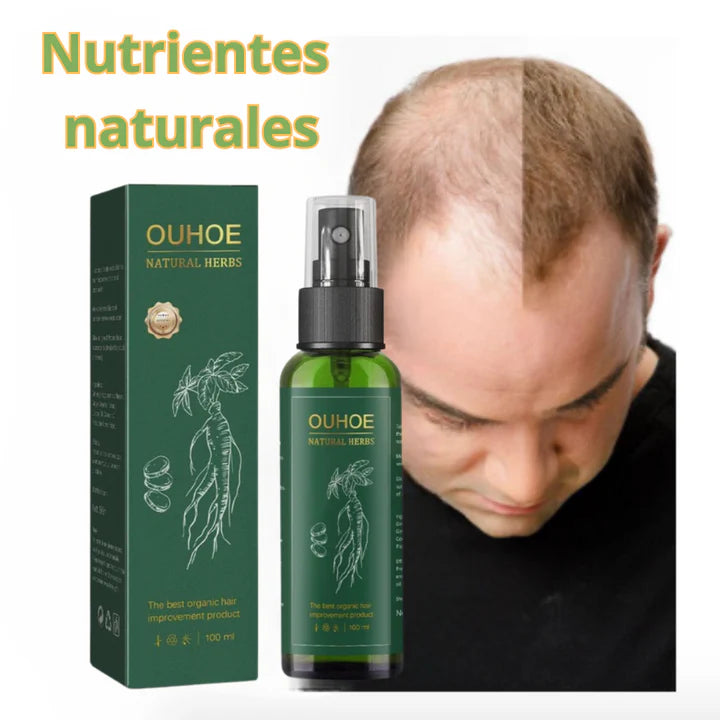 OUHOE ® ELIXIR CRECIMIENTO Y CONTROL DE CAIDA CAPILAR !