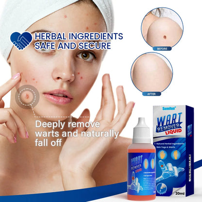 2X1 WART REMOVER LIQUID™ - SERUM REMOVEDOR DE VERRUGAS, LUNARES, MEZQUINOS, MARCAS EN LA PIEL